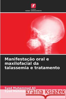 Manifesta??o oral e maxilofacial da talassemia e tratamento Syed Muhammad Ali Syed Mahmood Haider 9786207793174