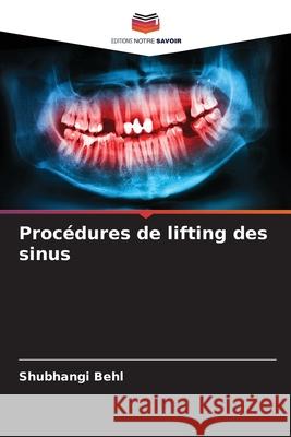 Proc?dures de lifting des sinus Shubhangi Behl 9786207800322