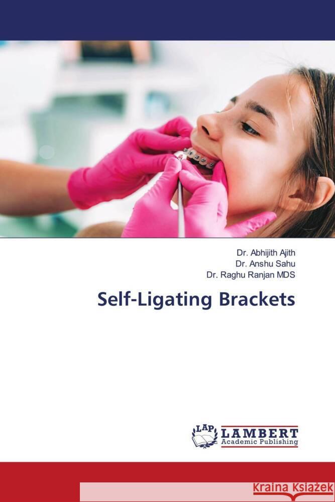 Self-Ligating Brackets Abhijith Ajith Anshu Sahu Raghu Ranja 9786207804863