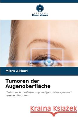 Tumoren der Augenoberfläche Akbari, Mitra 9786207824373