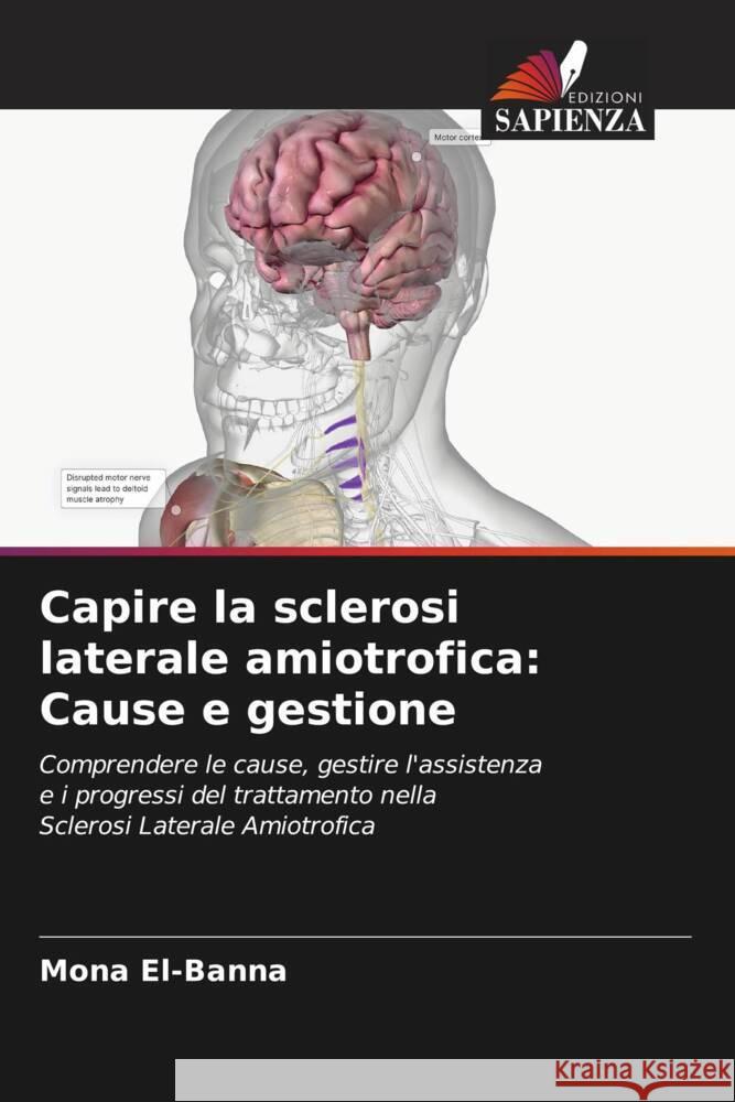Capire la sclerosi laterale amiotrofica: Cause e gestione El-Banna, Mona 9786207839445