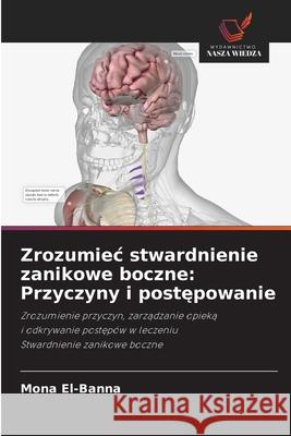 Zrozumiec stwardnienie zanikowe boczne: Przyczyny i postepowanie El-Banna, Mona 9786207839452