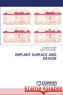 Implant Surface and Design Shubham Kumar Sunita Choudhary 9786207841691