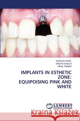 Implants in Esthetic Zone: Equipoising Pink and White Dhruva Patel Shilpa Duseja Hiral Parikh 9786207843923