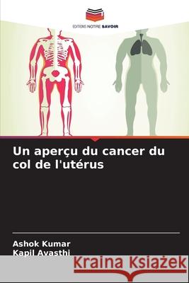 Un aper?u du cancer du col de l'ut?rus Ashok Kumar Kapil Avasthi 9786207863167