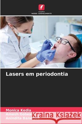 Lasers em periodontia Monica Kedia Amesh Golwara Anindita Banerjee 9786207866984 Edicoes Nosso Conhecimento