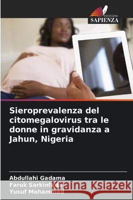 Sieroprevalenza del citomegalovirus tra le donne in gravidanza a Jahun, Nigeria Abdullahi Gadama Faruk Sarkinfada Yusuf Mohammed 9786207873906