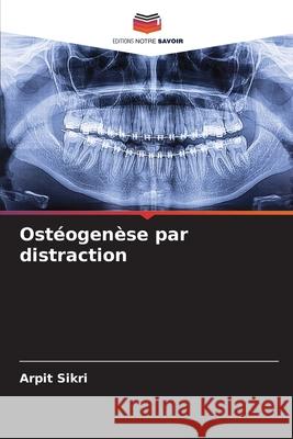 Ost?ogen?se par distraction Arpit Sikri 9786207876440