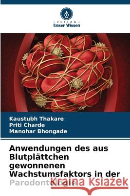 Anwendungen des aus Blutpl?ttchen gewonnenen Wachstumsfaktors in der Parodontologie Kaustubh Thakare Priti Charde Manohar Bhongade 9786207889969