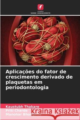 Aplica??es do fator de crescimento derivado de plaquetas em periodontologia Kaustubh Thakare Priti Charde Manohar Bhongade 9786207890002