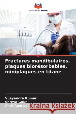 Fractures mandibulaires, plaques bior?sorbables, miniplaques en titane Vijayendra Kumar Shreya Gour Amit Agarwal 9786207891245 Editions Notre Savoir