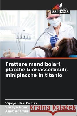 Fratture mandibolari, placche bioriassorbibili, miniplacche in titanio Vijayendra Kumar Shreya Gour Amit Agarwal 9786207891252 Edizioni Sapienza