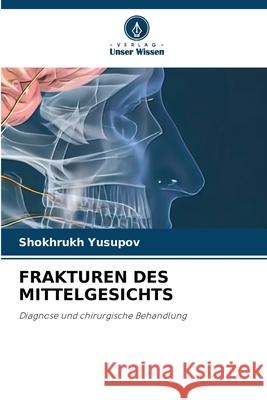 Frakturen Des Mittelgesichts Shokhrukh Yusupov 9786207894215