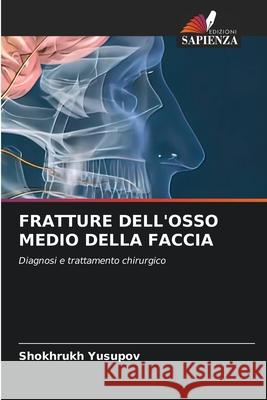 Fratture Dell'osso Medio Della Faccia Shokhrukh Yusupov 9786207894246