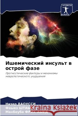 Ишемический инсульт в ос ДАОУСi  ШТАЫЭ ФРИХ-А 9786207896974 Sciencia Scripts