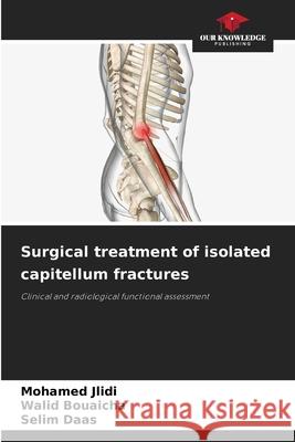 Surgical treatment of isolated capitellum fractures Mohamed Jlidi Walid Bouaicha Selim Daas 9786207897599 Our Knowledge Publishing