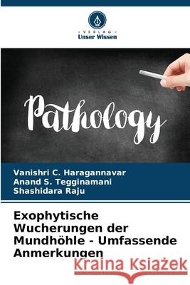 Exophytische Wucherungen der Mundh?hle - Umfassende Anmerkungen Vanishri C. Haragannavar Anand S. Tegginamani Shashidara Raju 9786207901302