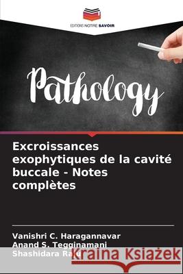 Excroissances exophytiques de la cavit? buccale - Notes compl?tes Vanishri C. Haragannavar Anand S. Tegginamani Shashidara Raju 9786207901326