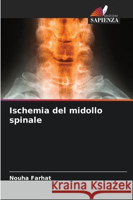 Ischemia del midollo spinale Nouha Farhat 9786207904358