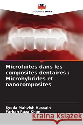 Microfuites dans les composites dentaires: Microhybrides et nanocomposites Syeda Mahvish Hussain Farhan Raza Khan 9786207908400 Editions Notre Savoir