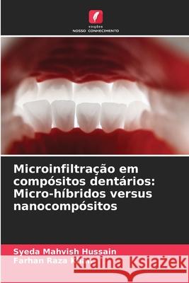 Microinfiltra??o em comp?sitos dent?rios: Micro-h?bridos versus nanocomp?sitos Syeda Mahvish Hussain Farhan Raza Khan 9786207908431 Edicoes Nosso Conhecimento