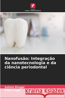 Nanofus?o: Integra??o da nanotecnologia e da ci?ncia periodontal Sohini Dingal Rika Singh 9786207910328