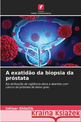 A exatid?o da biopsia da pr?stata Intisar Ghleilib 9786207911592 Edicoes Nosso Conhecimento