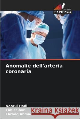 Anomalie dell'arteria coronaria Noorul Hadi Tahir Shah Farooq Ahmad 9786207914128