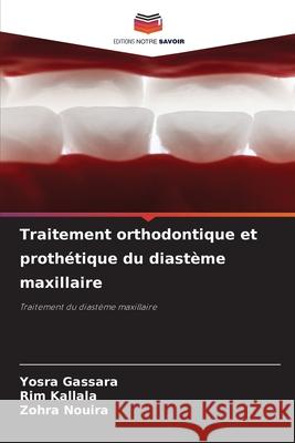 Traitement orthodontique et proth?tique du diast?me maxillaire Yosra Gassara Rim Kallala Zohra Nouira 9786207915002