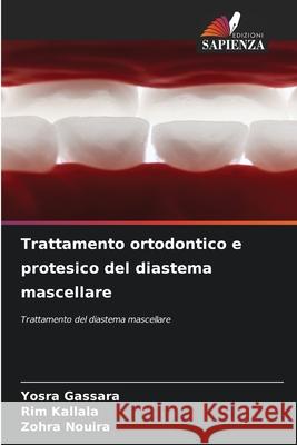 Trattamento ortodontico e protesico del diastema mascellare Yosra Gassara Rim Kallala Zohra Nouira 9786207915019