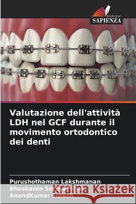 Valutazione dell'attivit? LDH nel GCF durante il movimento ortodontico dei denti Purushothaman Lakshmanan Bhaskaran Sathyapriya Anandkumar Suresh 9786207917167