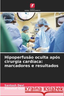 Hipoperfus?o oculta ap?s cirurgia card?aca: marcadores e resultados Santosh Devi Showkat Gurcoo 9786207921485 Edicoes Nosso Conhecimento