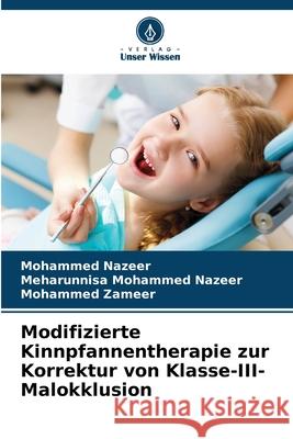 Modifizierte Kinnpfannentherapie zur Korrektur von Klasse-III-Malokklusion Mohammed Nazeer Meharunnisa Mohamme Mohammed Zameer 9786207925360