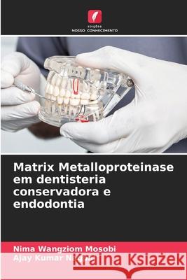 Matrix Metalloproteinase em dentisteria conservadora e endodontia Nima Wangziom Mosobi Ajay Kumar Nagpal 9786207928460 Edicoes Nosso Conhecimento