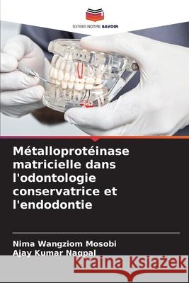 M?talloprot?inase matricielle dans l'odontologie conservatrice et l'endodontie Nima Wangziom Mosobi Ajay Kumar Nagpal 9786207928491 Editions Notre Savoir