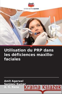 Utilisation du PRP dans les d?ficiences maxillo-faciales Amit Agarwal Sanjeev Kumar A. S. Rana 9786207931057 Editions Notre Savoir