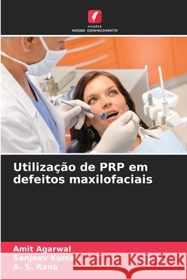 Utiliza??o de PRP em defeitos maxilofaciais Amit Agarwal Sanjeev Kumar A. S. Rana 9786207931071 Edicoes Nosso Conhecimento