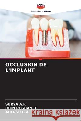 Occlusion de l'Implant Surya A John Rosha Adersh G 9786207931644 Editions Notre Savoir