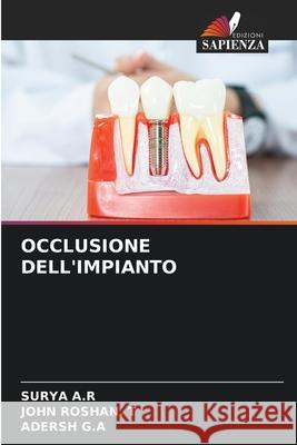 Occlusione Dell'impianto Surya A John Rosha Adersh G 9786207931682