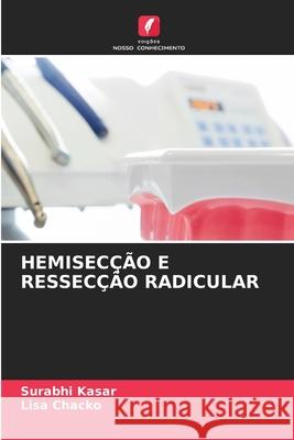 Hemisec??o E Ressec??o Radicular Surabhi Kasar Lisa Chacko 9786207933471 Edicoes Nosso Conhecimento