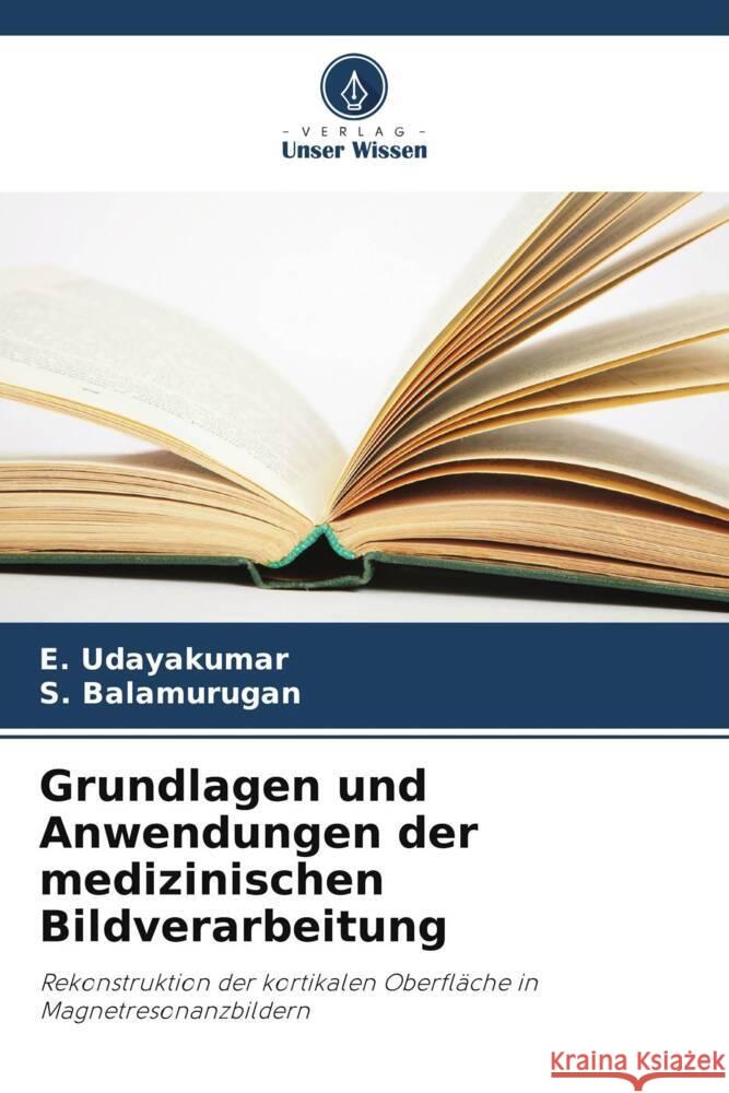 Grundlagen und Anwendungen der medizinischen Bildverarbeitung E. Udayakumar S. Balamurugan 9786207956067 Verlag Unser Wissen