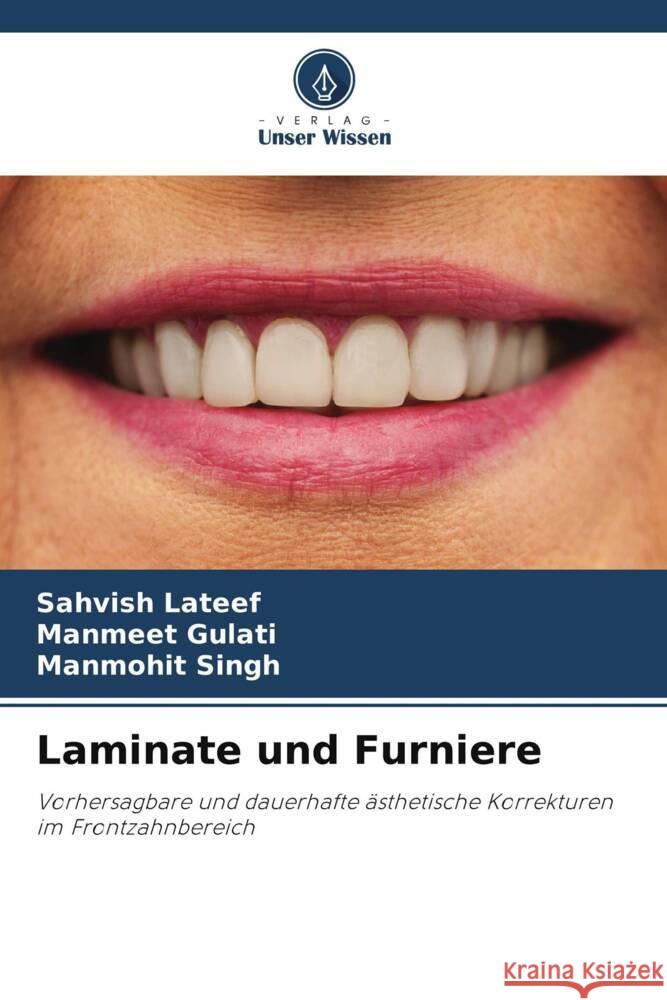 Laminate und Furniere Sahvish LaTeef Manmeet Gulati Manmohit Singh 9786207964079 Verlag Unser Wissen