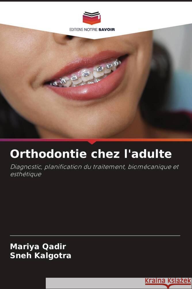 Orthodontie chez l'adulte Mariya Qadir Sneh Kalgotra 9786207966752 Editions Notre Savoir