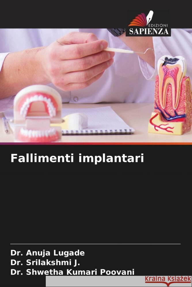 Fallimenti implantari Anuja Lugade Srilakshmi J Shwetha Kumari Poovani 9786207967469