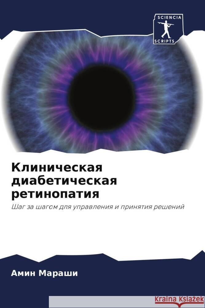 Klinicheskaq diabeticheskaq retinopatiq Marashi, Amin 9786207970681