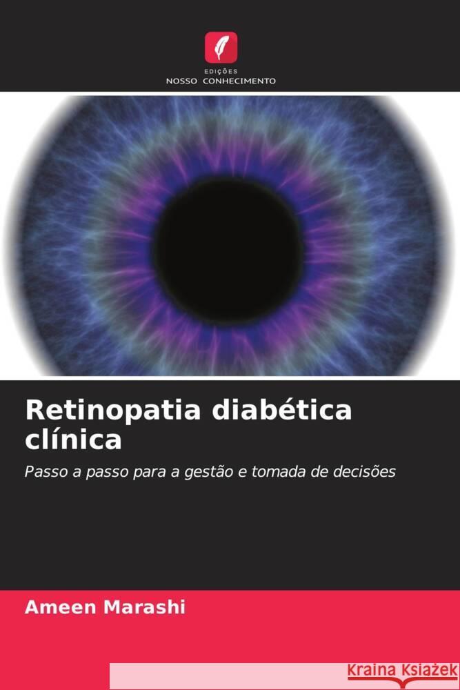 Retinopatia diab?tica cl?nica Ameen Marashi 9786207970735