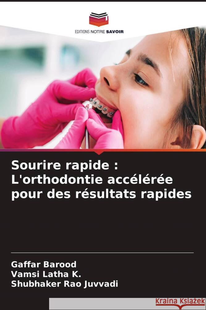 Sourire rapide: L'orthodontie acc?l?r?e pour des r?sultats rapides Gaffar Barood Vamsi Lath Shubhaker Rao Juvvadi 9786207972791