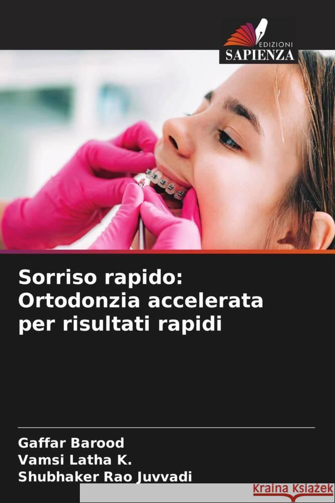 Sorriso rapido: Ortodonzia accelerata per risultati rapidi Gaffar Barood Vamsi Lath Shubhaker Rao Juvvadi 9786207972814