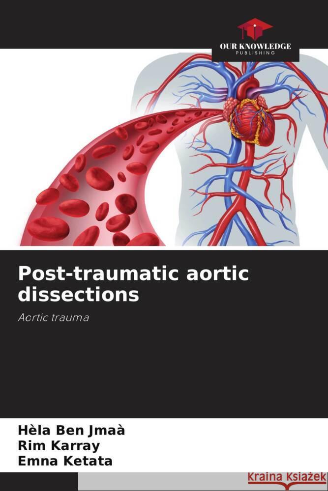 Post-traumatic aortic dissections H?la Be Rim Karray Emna Ketata 9786207983810