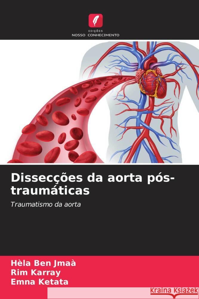 Dissec??es da aorta p?s-traum?ticas H?la Be Rim Karray Emna Ketata 9786207983834